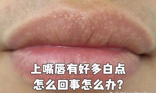 月经期间好喝姜茶吗女性-【月经期间喝姜茶可以吗】来月经喝姜茶好吗 - 月经期间好喝姜茶吗网